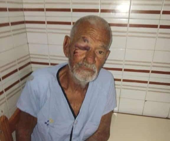 Desaparición de Manuel S.M. en Telde: el vecino de 86 años que se esfumó con un hematoma en el rostro
