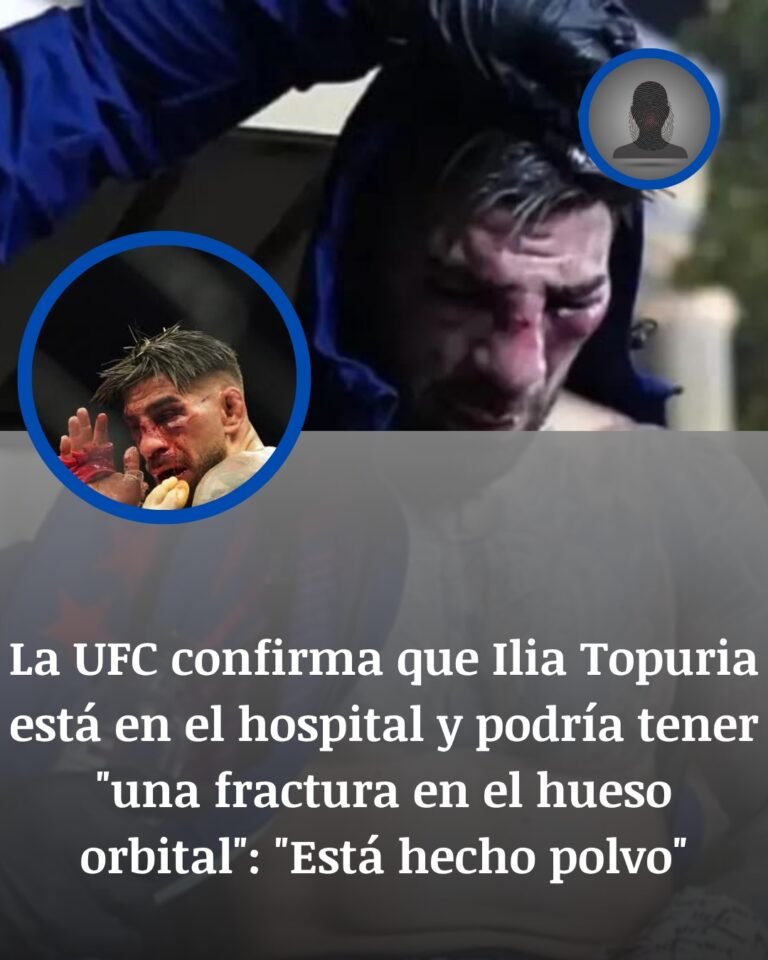 Ilia Topuria termina en el hospital tras perder con Justin Gaethje y la sospecha de fractura orbital agrava la noche