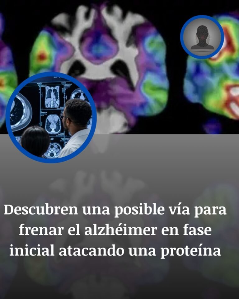 Una vía contra el alzhéimer: el golpe experimental contra la proteína tau que intenta frenar el deterioro inicial
