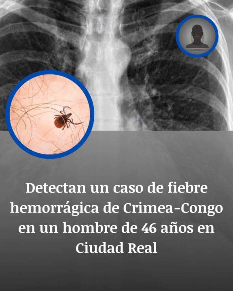 Caso de fiebre hemorrágica de Crimea-Congo en Ciudad Real: trasladan a un hombre de 46 años al Gómez Ulla