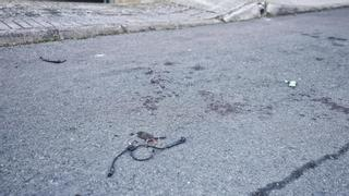 Palma: La Sangre en la Calle y el Ojo Herido en Son Ferriol (2026)