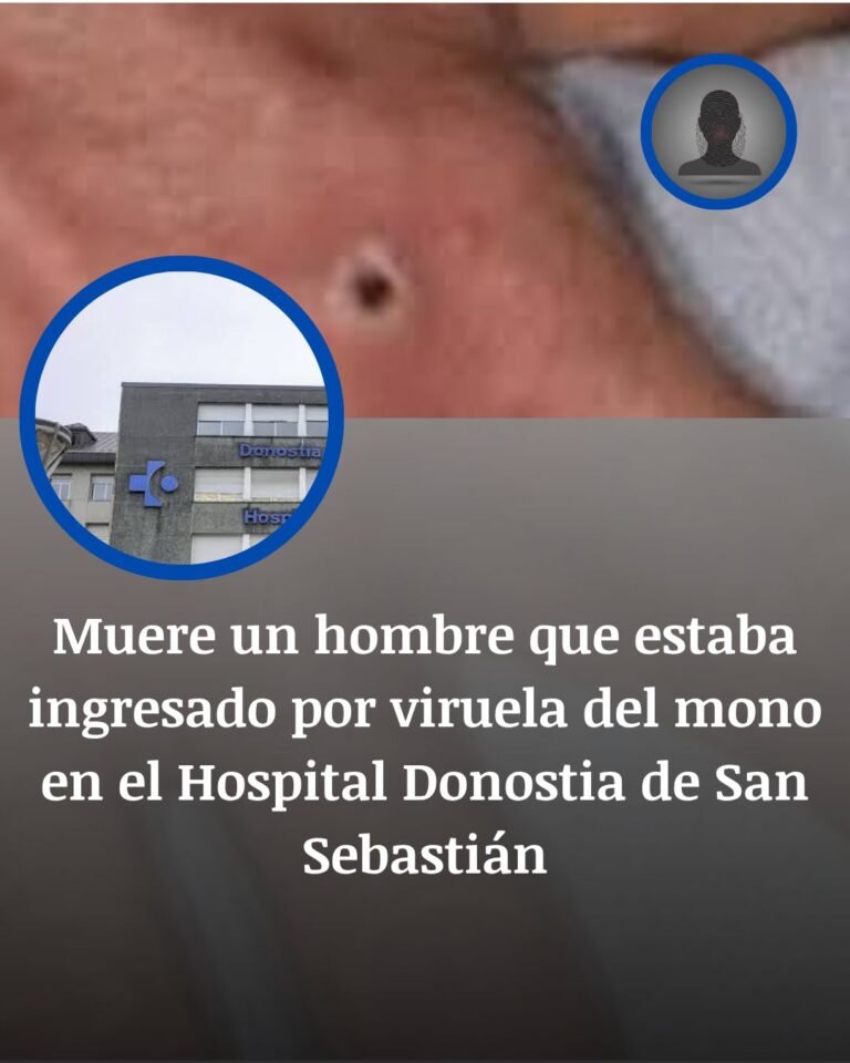 Muere un paciente con mpox tras contagiarse en el Hospital Donostia