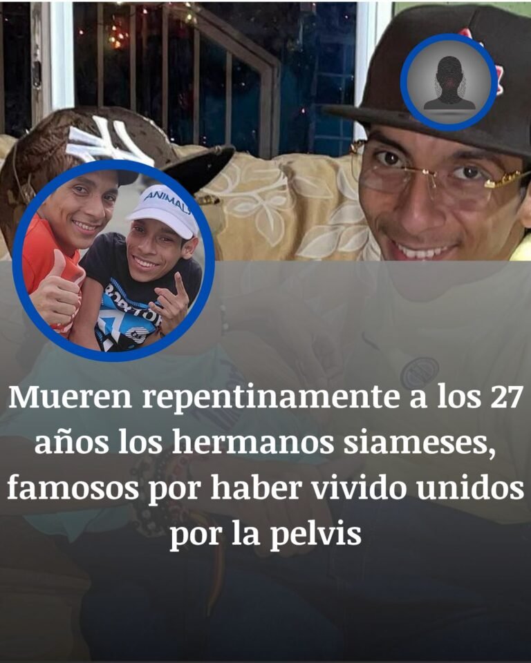 Mueren José Luis y José Armando Cevallos, los siameses de Ecuador que desafiaron todos los pronósticos